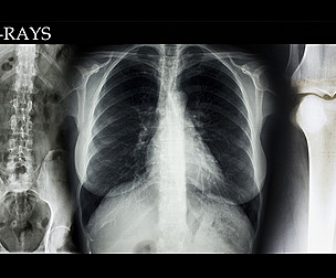 81 X-RAYS -VOL 2