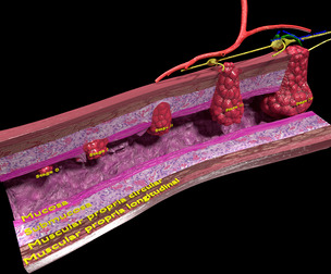 colon cancer stages labelled detail