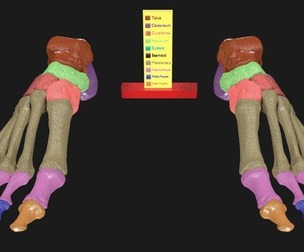 Foot Seperated Bones With colour coded