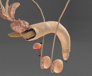 Seminal fluid according to cause of azoospermia