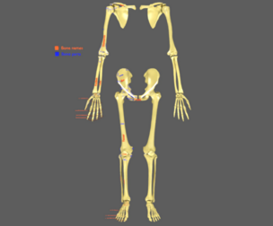 Limbs With Girdle bones name parts text labelled
