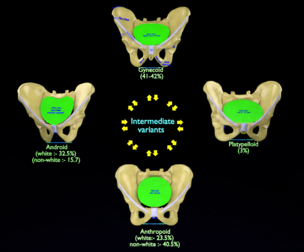 Pelvis types hip bone labelled detailed