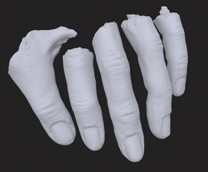 Severed Fingers