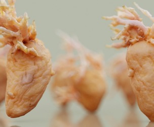10 Shriveled Potatoes