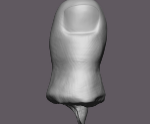 Severed Toe