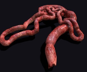 Intestines Piles