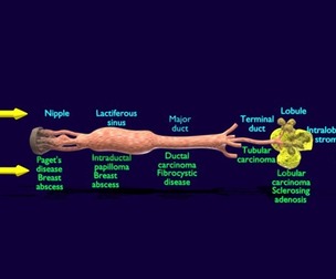 Breast duct sites and diseases