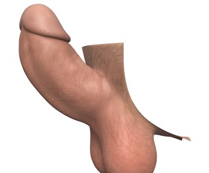 Man Small Erect Monster Penis