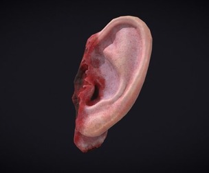Severed Ear