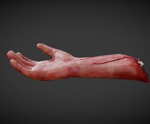 Severed Arm