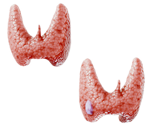 Healthy Thyroid and Thyroid Cancer