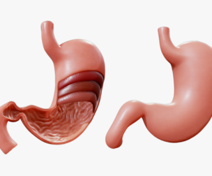 Stomach Complete Version