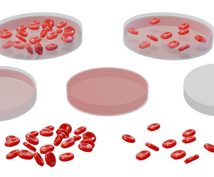 Normal Blood Cells vs Anemia