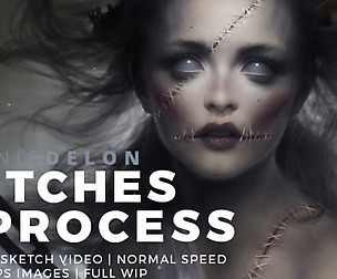 Stitches