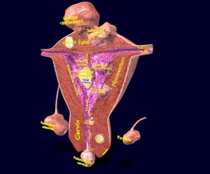 Fibroid Uterus Human female 3D