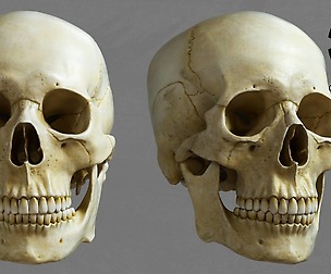 Skull