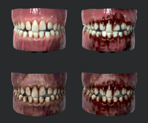 Gums Teeth and Tongue