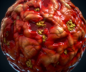 Infection Material - VOL 04 - SBS - Maps