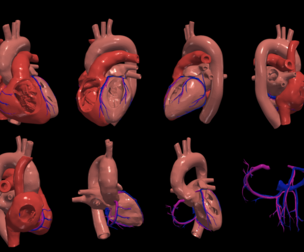 Congenital Heart Disease - 7pack