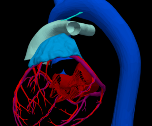 3D Heart Anatomy with Codominance