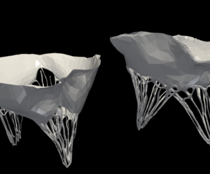 3D Model of Valves