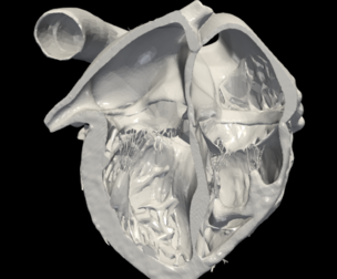 3D Model of Heart (apical 4 chamber plane)