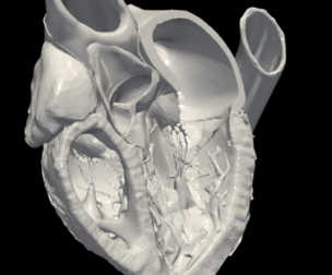3D Model of Heart (apical 3 chamber plane)