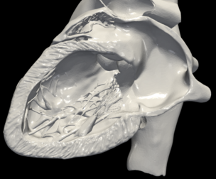3D Model of Heart (apical 2 chamber plane)