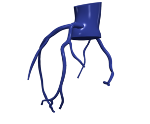 3D Model of Coronary Arteries