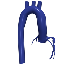 3D Model of Aorta and Coronary Arteries