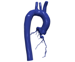 3D Model of Aorta and Coronary Arteries