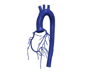 3D Model of Aorta and Coronary Arteries