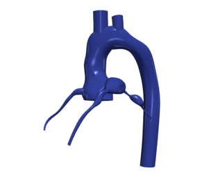 3D Model of Aorta and Coronary Arteries