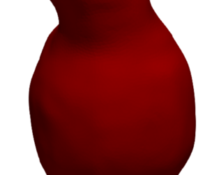 Model of an abdominal aortic aneurysm from a real patient