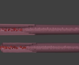3D Model of Blood Vessels Anatomy
