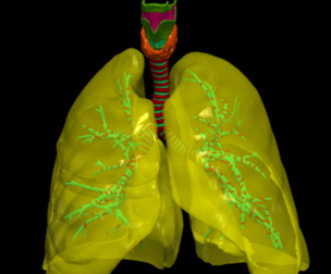 3D Model of the Lungs Airways