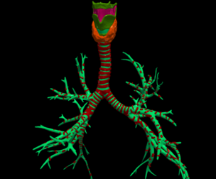 3D Model of Airways