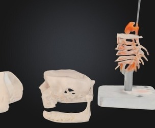 3D Model of Spinal Cord Model with Nerves