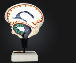 3D Model of Cerebrospinal Fluid Brain