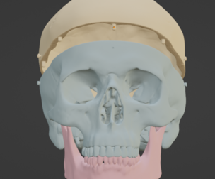 3D Model of Skull, Skull Cap and Mandible