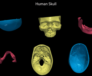 3D Human Skull - Cap, Mandible