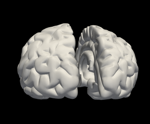3D Model of Left and Right Brain