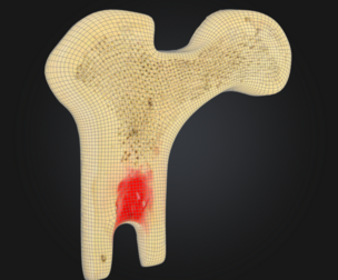 Human Bone Microstructure with Long Bone Osteon