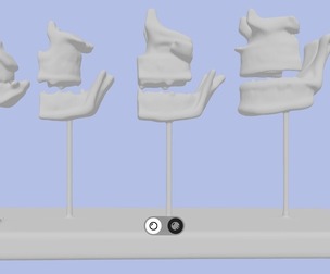 3D Model of Dentition Development Anatomy On Stand