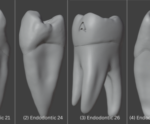 3D Model of Endodontics Bundle - 6 pack