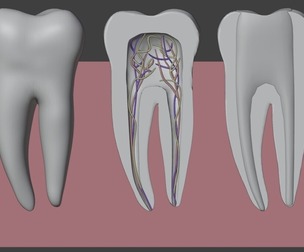 3D Model of Second Molar Anatomy