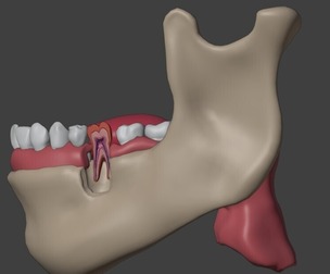 3D Dental Model of Teeth - Cross Section