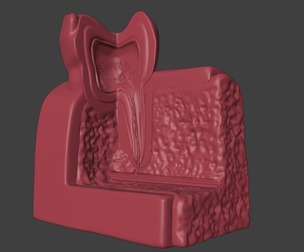 3D Dental Model