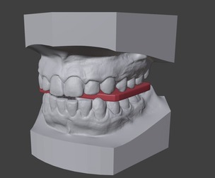 3D Teeth, Tounge, Mouth - Dental Model