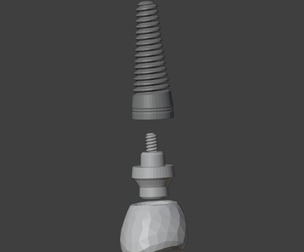 3D Model of Dental Implant